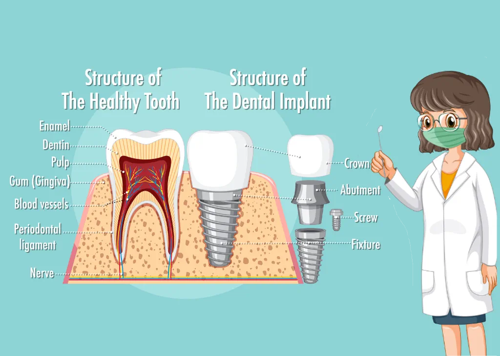 What are the long term effects of dental implants?